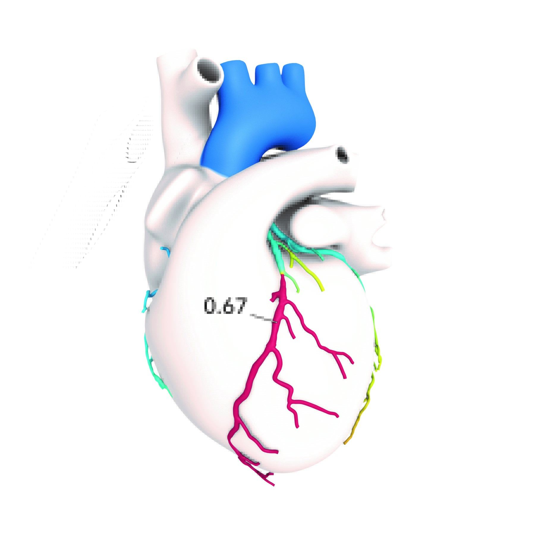 Heartflow diagram
