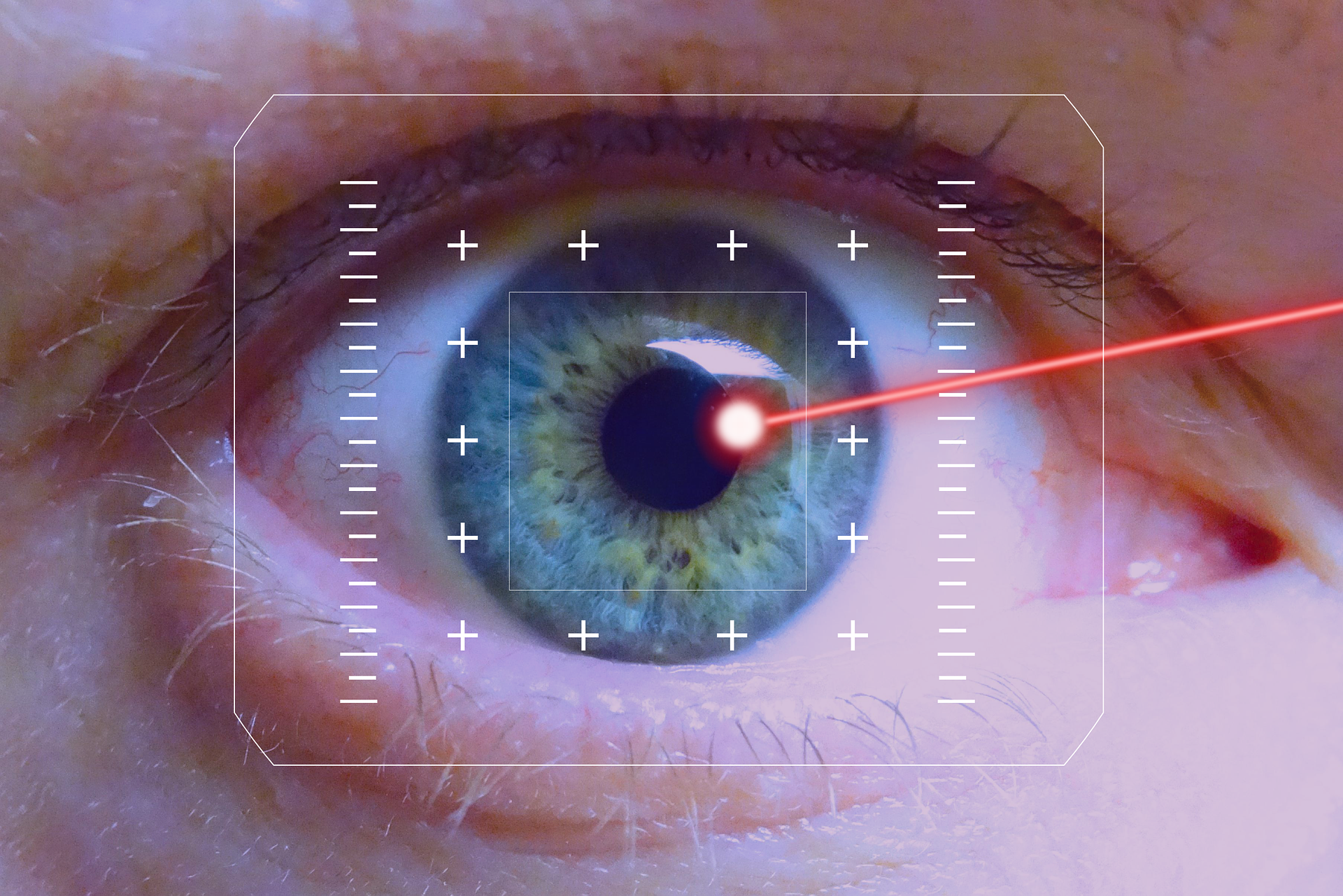 laser-eyes