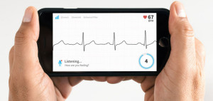 Mobile showing ECG